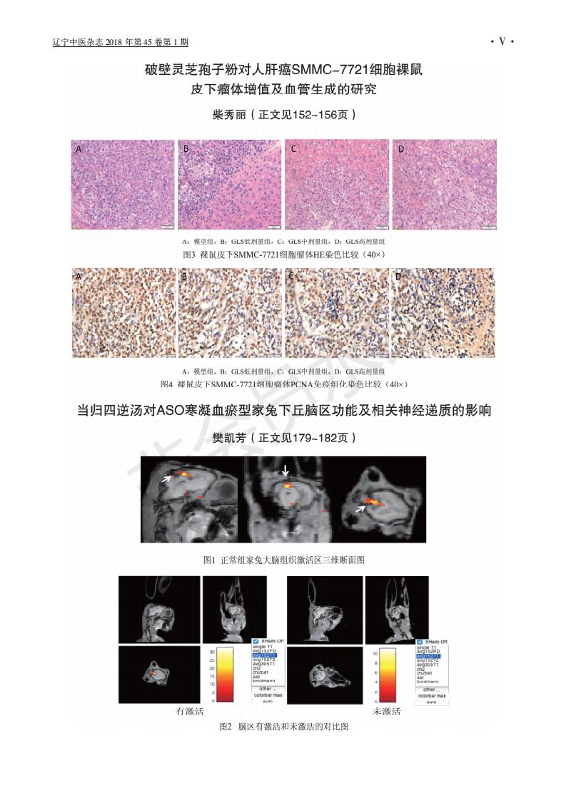 243 破壁靈芝孢子粉對人肝癌SMMC-7721細胞裸鼠皮下瘤體增殖及血管生成的研究_04.jpg