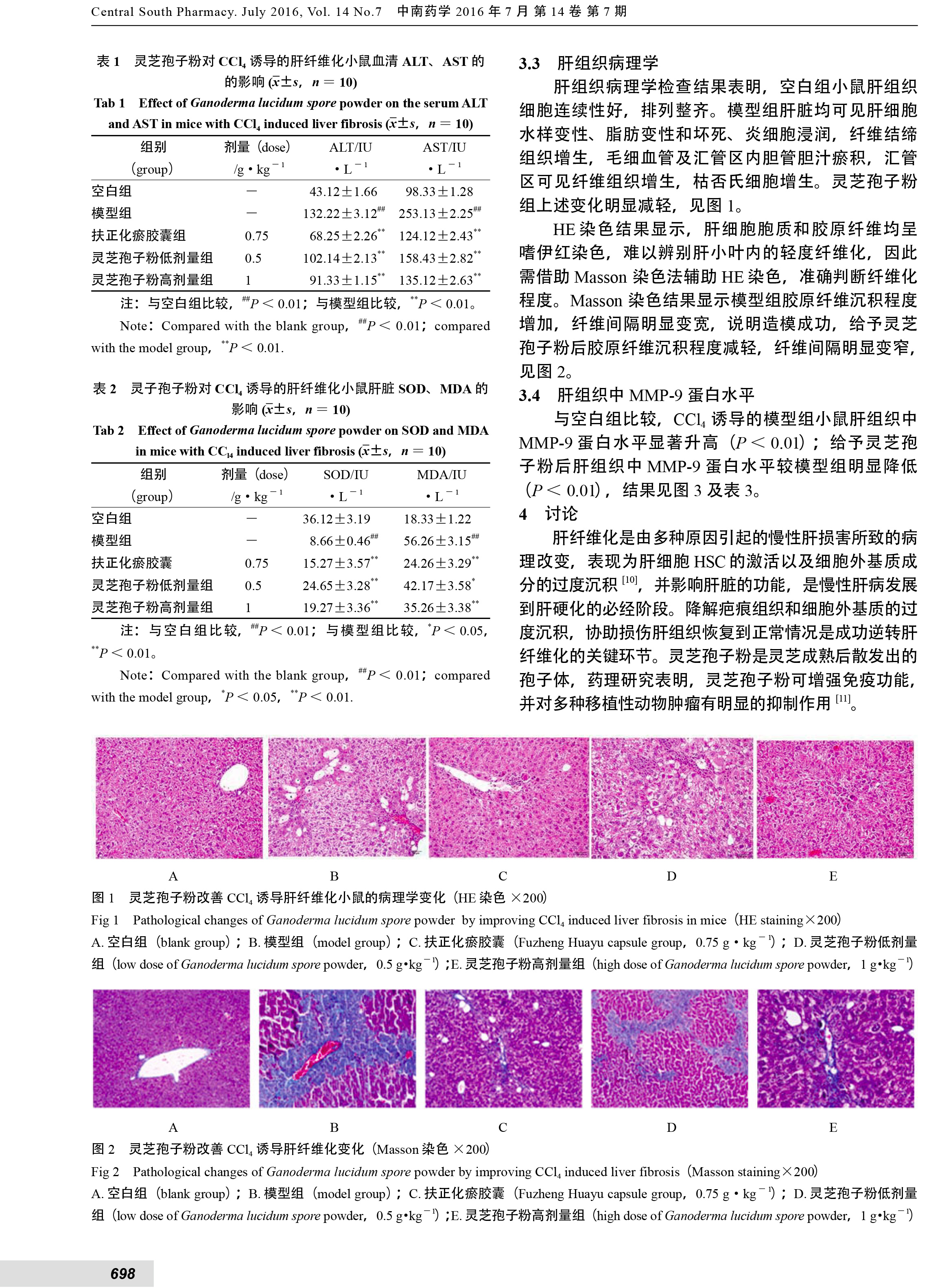 221 靈芝孢子粉保護CCl_4引起的小鼠肝纖維化損傷的實驗研究-3.jpg